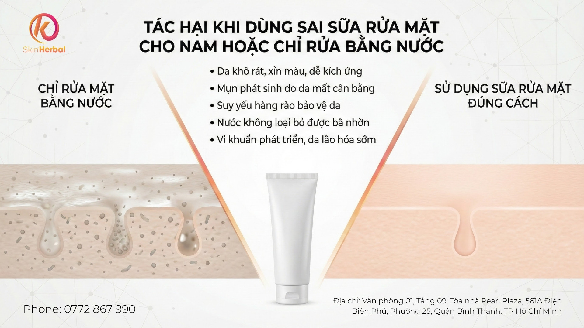 T&aacute;c hại khi d&ugrave;ng sai sản phẩm hoặc chỉ rửa bằng nước